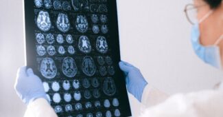 le neurologue